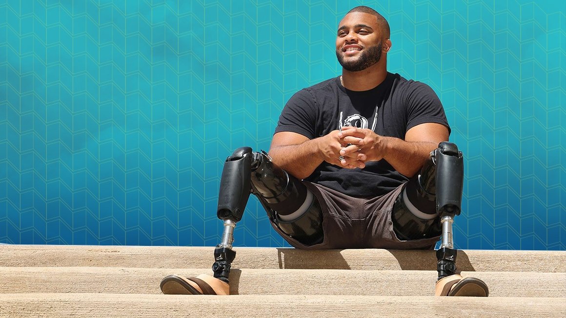 Brian Douglas sitting on steps with elbows resting on his prosthetic legs.