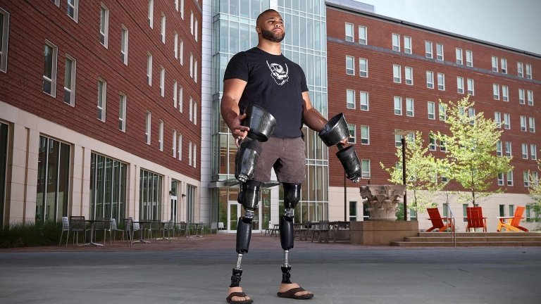 Brian Douglas stands in front of a brick building wearing prosthetic legs and holding an additional pair in his hands.